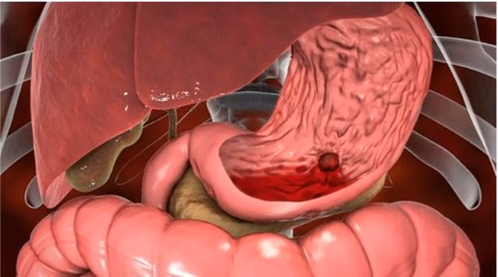 H&igrave;nh ảnh minh họa cảnh b&aacute;o lạm dụng thuốc giảm đau