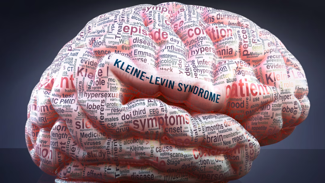The exact cause of KLS is unknown, although researchers suggest that it may be genetic or the result of an illness or injury that damages the hypothalamus.