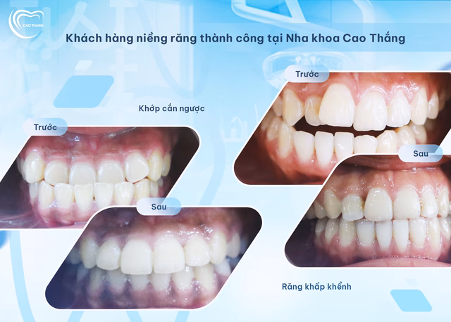 Nha khoa Cao Thắng: Nâng tầm chất lượng điều trị với công nghệ hiện đại Nha khoa Cao Thắng: Chỉn chu để tốt hơn- Ảnh 3.