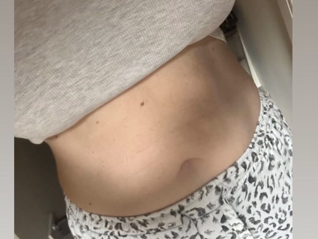 Elaine shows off her 'current belly situation'.