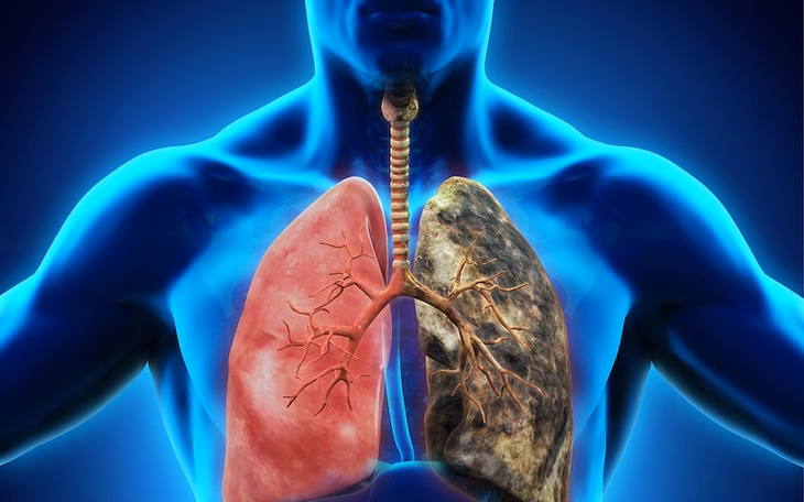 Nhiều lãnh đạo doanh nghiệp lớn từ nhiệm, thị trường trái phiếu dần phục hồi Tin tức sáng 24-7: 24.000 người Việt mắc ung thư phổi mỗi năm; 3 lãnh đạo FPT Telecom từ nhiệm - Ảnh 4.