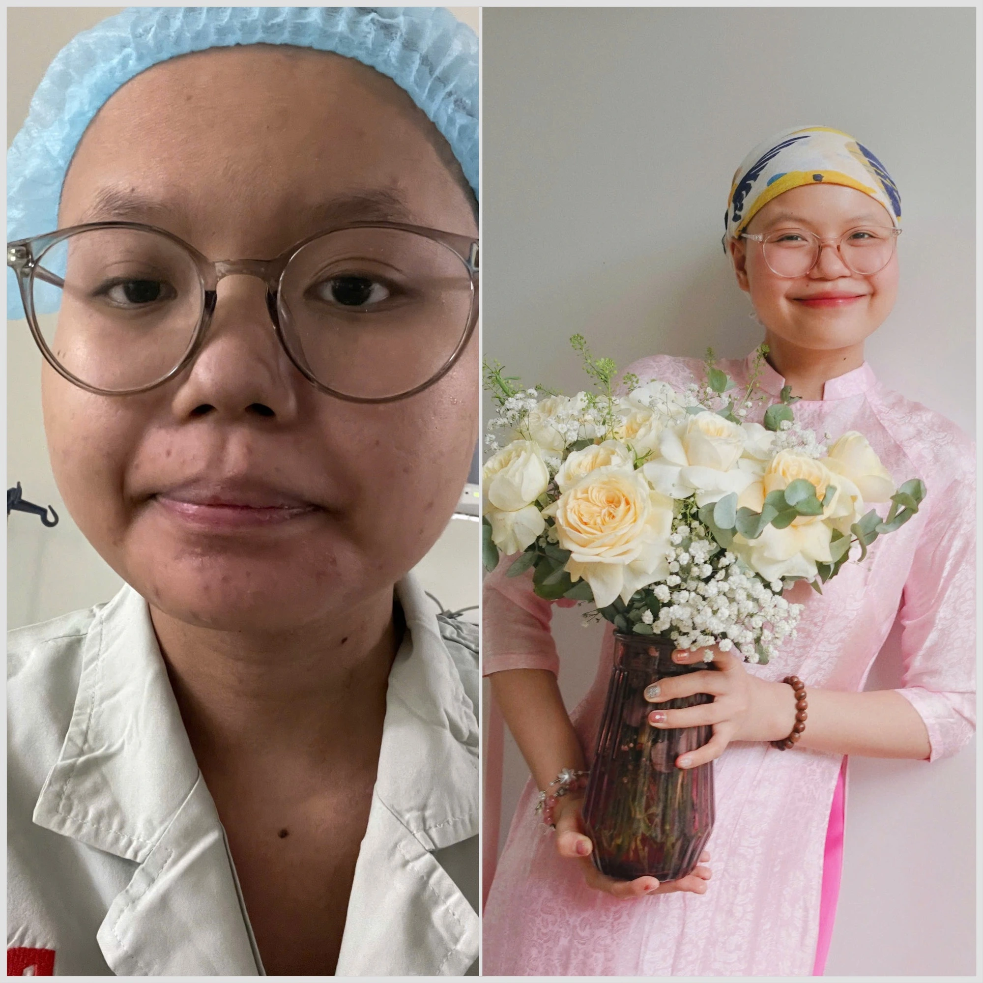 Cô gái trẻ từng muốn bỏ cuộc nhưng đã chọn sự lạc quan hơn, tích cực trong quá trình trị bệnh