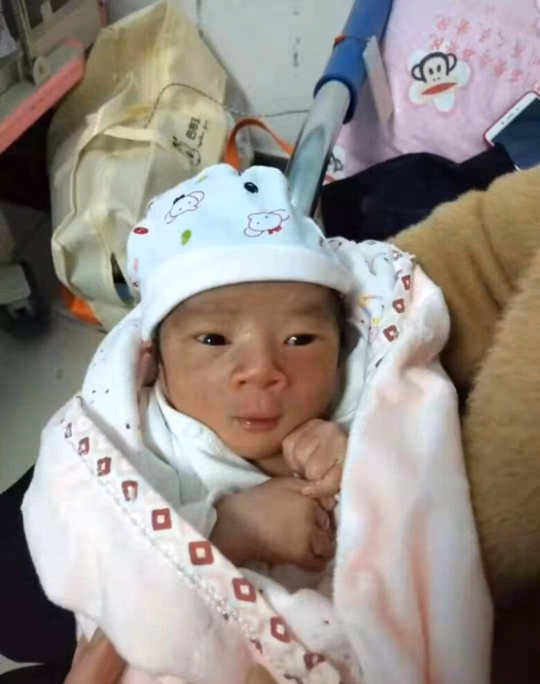 B&eacute; sơ sinh da nhăn nheo ngay sau sinh