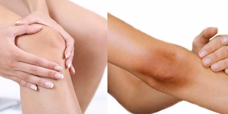 Để l&agrave;m s&aacute;ng v&ugrave;ng da đầu gối v&agrave; khuỷu tay, việc dưỡng ẩm đều đặn v&agrave; tẩy tế b&agrave;o chết đ&uacute;ng c&aacute;ch l&agrave; hai yếu tố then chốt. 