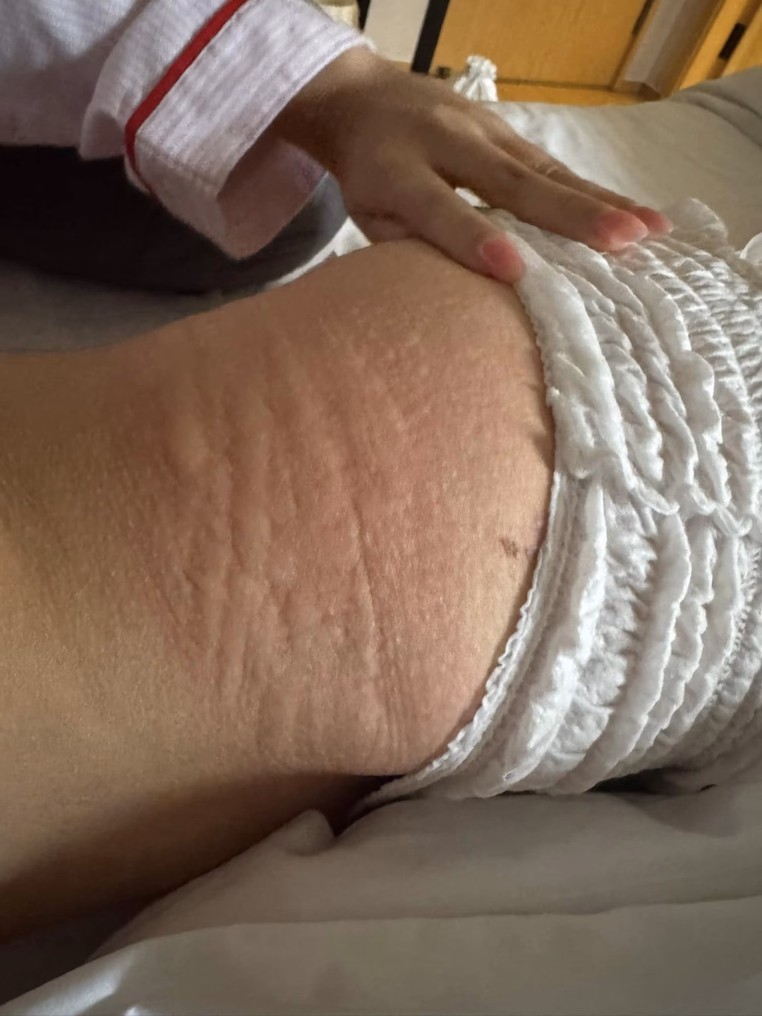 Phương Mỹ Chi gặp vấn đề sức khỏe sau biểu diễn Phương Mỹ Chi gặp nguy, bác sĩ cũng đành bó tay- Ảnh 5.