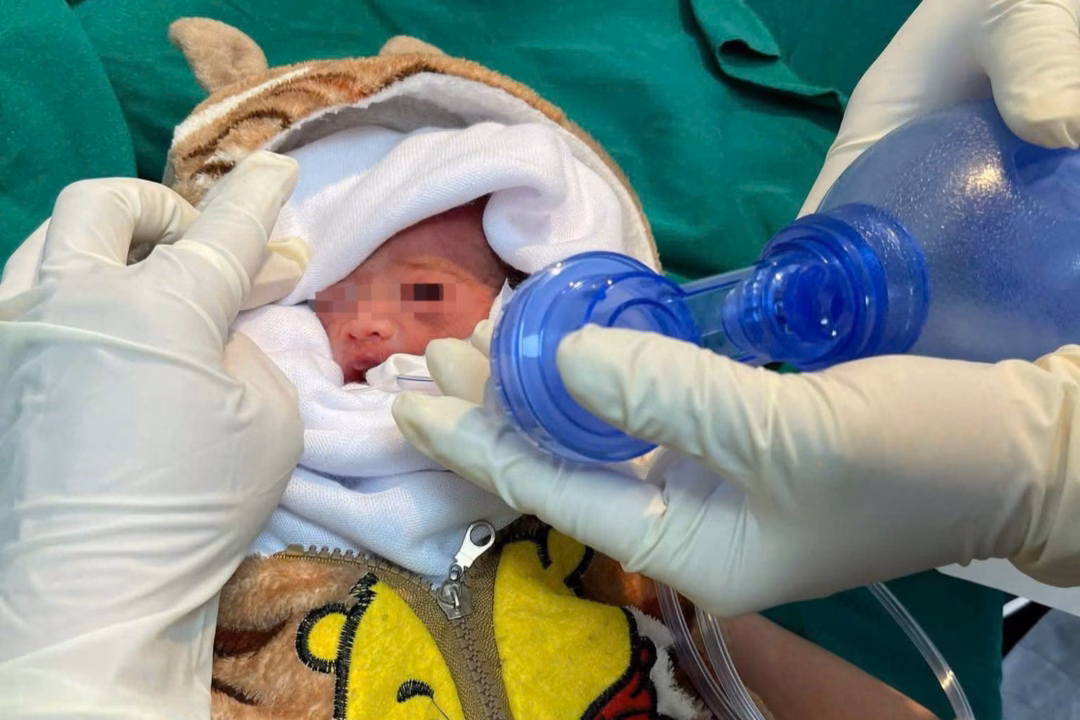 Hiện sức khỏe cháu bé đã tạm thời ổn định. Hiện sức khỏe cháu bé đã tạm thời ổn định.