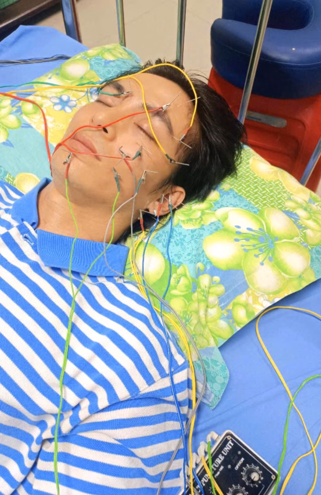 Lãnh Thanh điều trị liệt dây thần kinh Lãnh Thanh trong quá trình điều trị liệt mặt