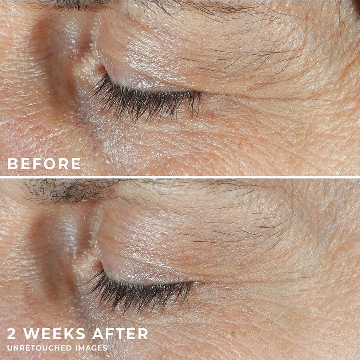 3 sản phẩm chăm sóc da đáng tiền giúp bạn ‘đánh bại’ mụn và lão hóa Close-up of eyes; top labeled "Before" showing wrinkles, bottom labeled "2 Weeks After" with visibly smoother skin. Text: "Clinically Proven to Lift & Smooth."