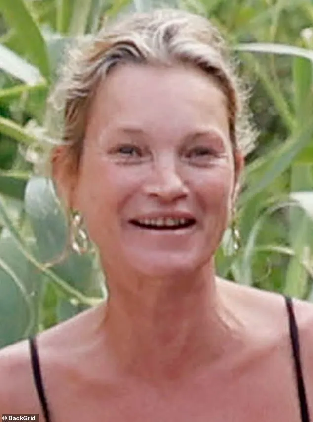Mặt mộc gây sốc của Kate Moss