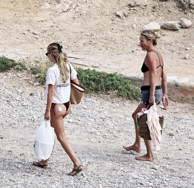 Mặt mộc gây sốc của Kate Moss