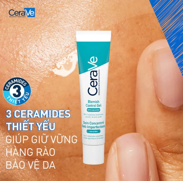 4 kem trị mụn giá rẻ nhưng cực hiệu quả cho cả mụn nặng Top 4 kem trị mụn giá rẻ mà hiệu quả với cả mụn thể nặng - Ảnh 4.