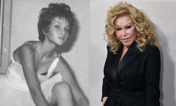 Jocelyn Wildenstein và bí mật đằng sau phẫu thuật mắt mèo – Câu chuyện “Miêu nữ”
