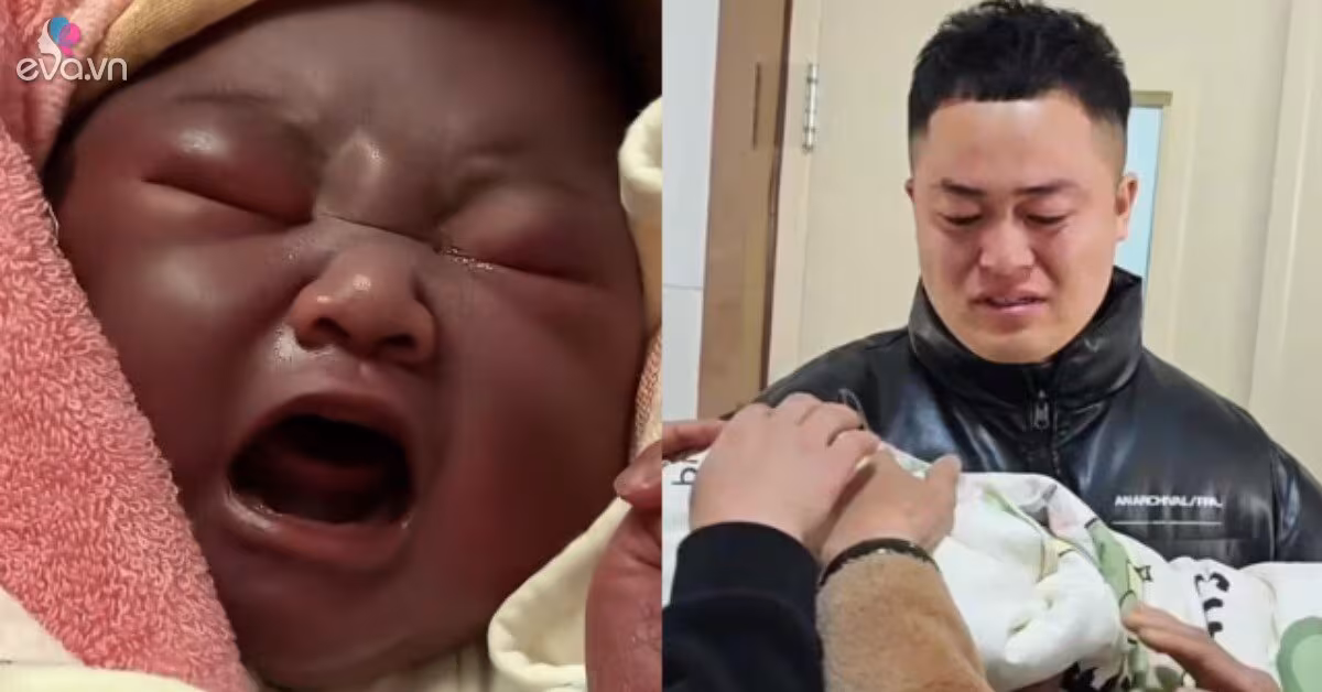 Khi bé sinh thường da tím đen: Nguyên nhân, rủi ro và cách phòng ngừa