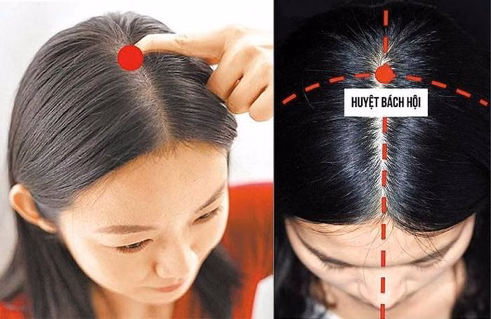 Huyệt B&aacute;ch hội tr&ecirc;n đầu