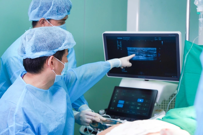 Cằm bị hoại tử vì tiêm filler không đúng cách Bác sĩ ứng dụng công nghệ siêu âm AI trong phẫu thuật nạo hút filler. Ảnh: Bệnh viện cung cấp