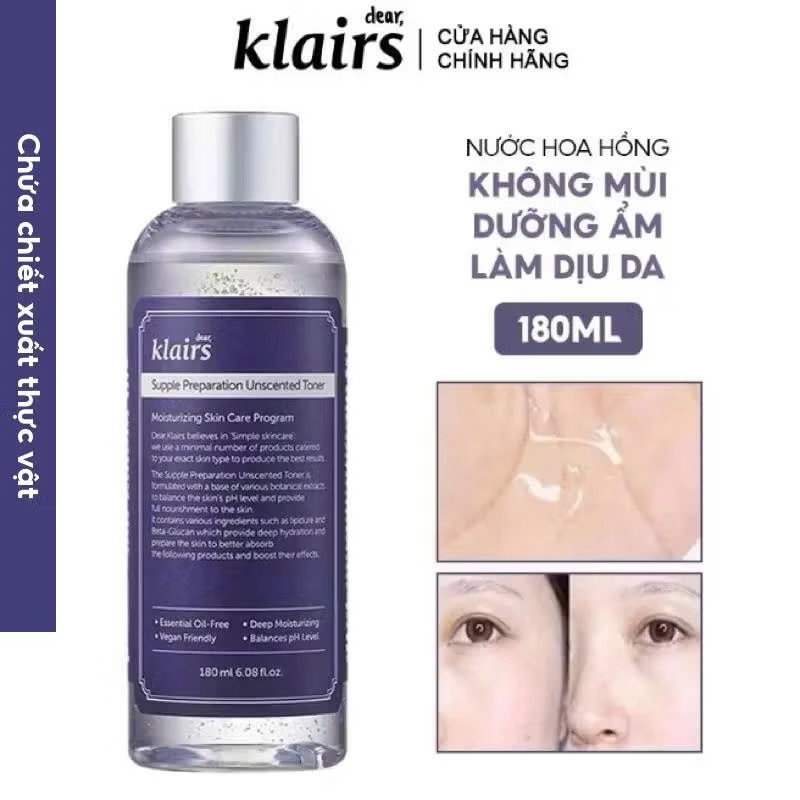 Làm thế nào để chọn nước toner phù hợp với làn da nhạy cảm của bạn?