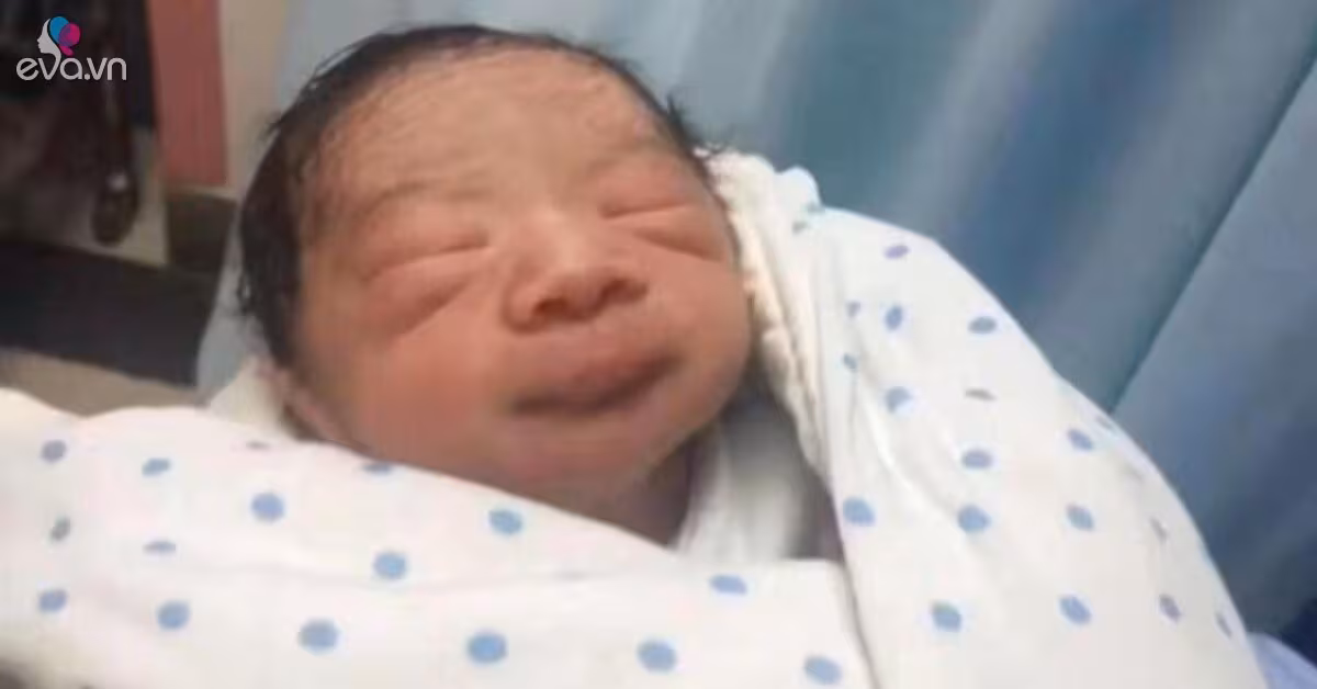 Bé sơ sinh da nhăn như “khỉ con” – 6 tháng sau biến thành “soái ca nhí” và 7 nguyên nhân thường gặp