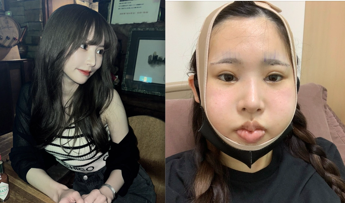 Câu chuyện Rara: Đầu tư 127.000 USD cho ca đại phẫu tại Hàn Quốc để “lột xác”