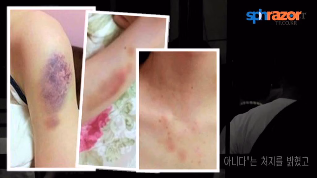 Nam thần Vườn Sao Băng giờ ra sao sau chuỗi scandal bạo hành? Scandal bạo hành của Kim Hyun Joong khiến showbiz chấn động