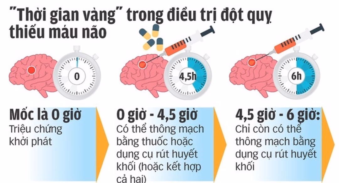 Cảnh báo nguy cơ đột quỵ có thể xảy ra bất cứ lúc nào và cách xử trí “Giờ vàng” cấp cứu đột quỵ thường chỉ kéo dài từ 3 đến 6 giờ đầu sau khởi phát.