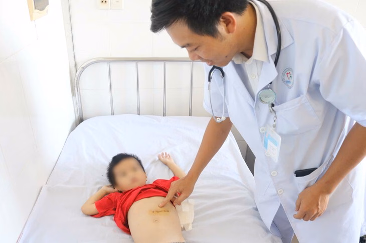 Gắp thành công búi tóc 0,5kg trong dạ dày bé trai 5 tuổi Búi tóc được các bác sĩ phẫu thuật gắp ra khỏi dạ dày bệnh nhân - Ảnh: Bệnh viện cung cấp