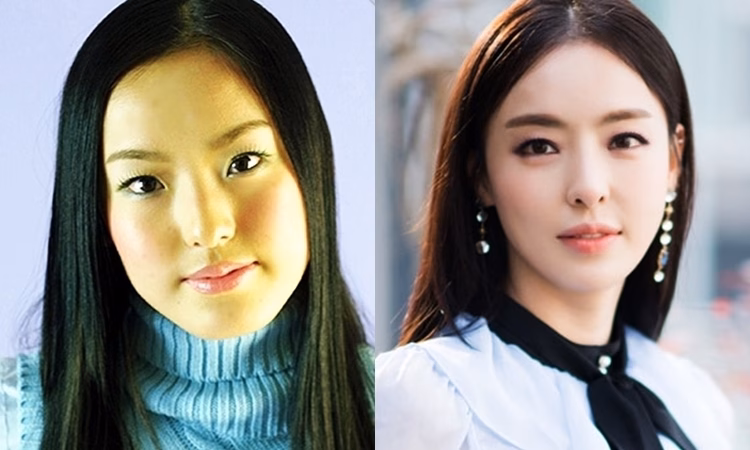 Lee Da Hee trước và sau khi dao kéo
