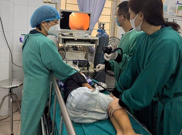 Hình ảnh chiếc long đen trong thực quản bệnh nhân. Ảnh Bệnh viên đa khoa Hà Nam