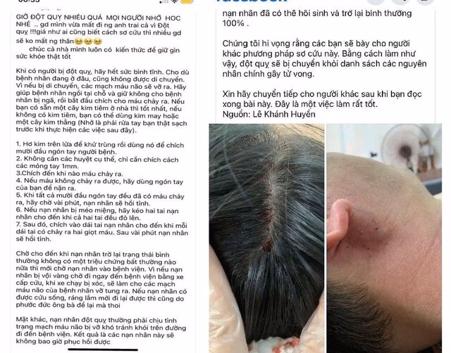 Sơ cứu đột quỵ đúng cách Không nên tin vào phương pháp "chích máu ở đầu ngón tay và dái tai" để chữa đột quỵ. Ảnh minh họa.