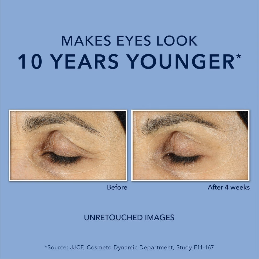 Skincare product advertisement showing a close-up of eyes before and after 4 weeks of use, claiming to make eyes look 10 years younger