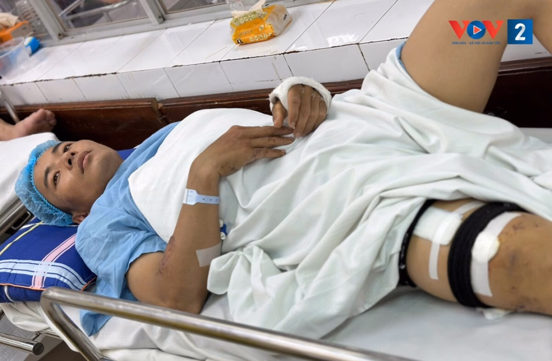 Nghịch cảnh người đàn ông Mông ‘gánh trên vai’ con trâu để chữa xương gãy