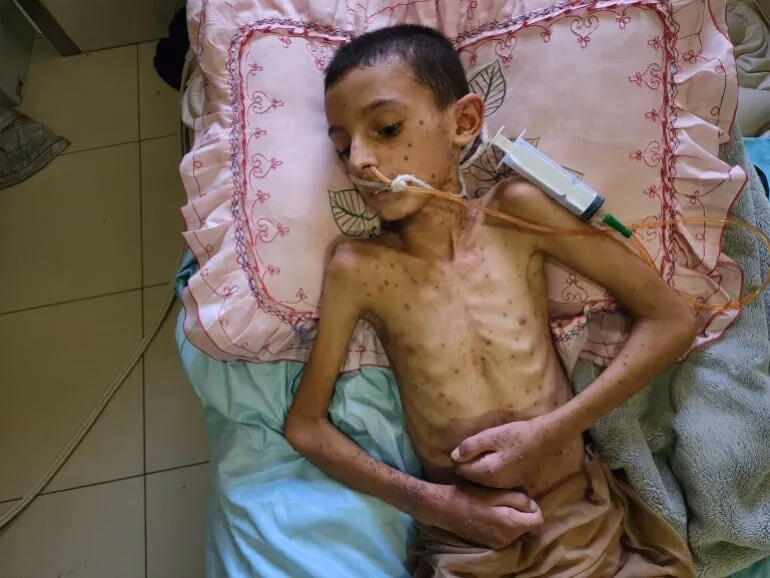 Palestine kêu gọi bảo vệ xe cứu trợ trong bối cảnh Israel bị cáo buộc sử dụng ‘đói nghèo như vũ khí’