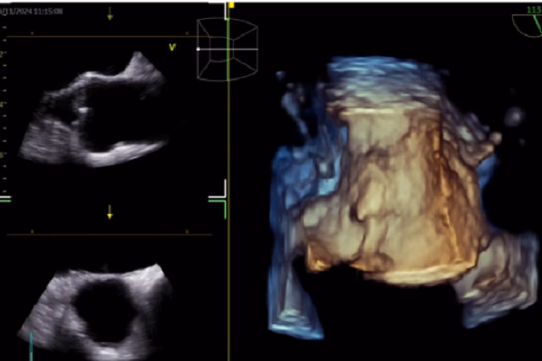 Trí tuệ nhân tạo tái định hình chăm sóc tim mạch như thế nào?