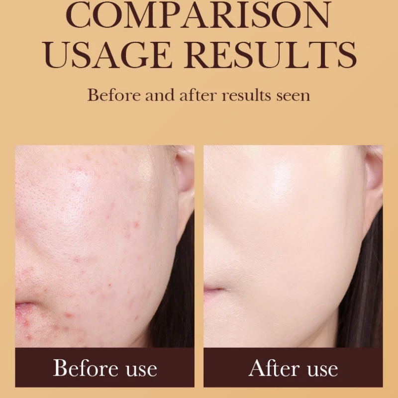 Tôi đã bỏ qua bước chống nắng trong bao lâu, và đây là những gì tôi học được khi sử dụng kem BB chống nắng SADOER