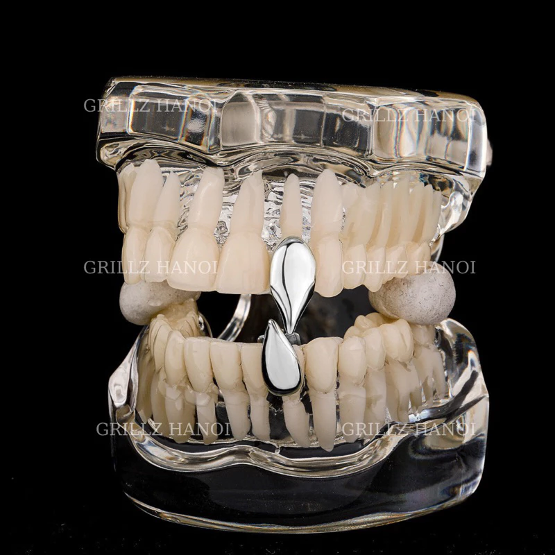 Làm thế nào để đeo grillz răng mà không gây khó chịu hay ảnh hưởng đến răng?