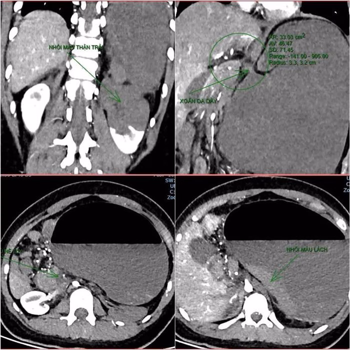 Bệnh viện Hữu Nghị Việt Nam – Cuba Đồng Hới: Tuyên bố tử vong bệnh nhân Down