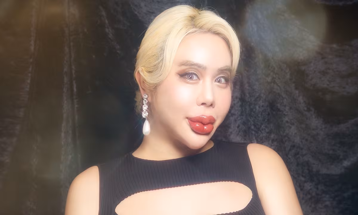 Allen chi hơn 100 triệu yen để trả thù kẻ chế giễu bằng phẫu thuật thẩm mỹ