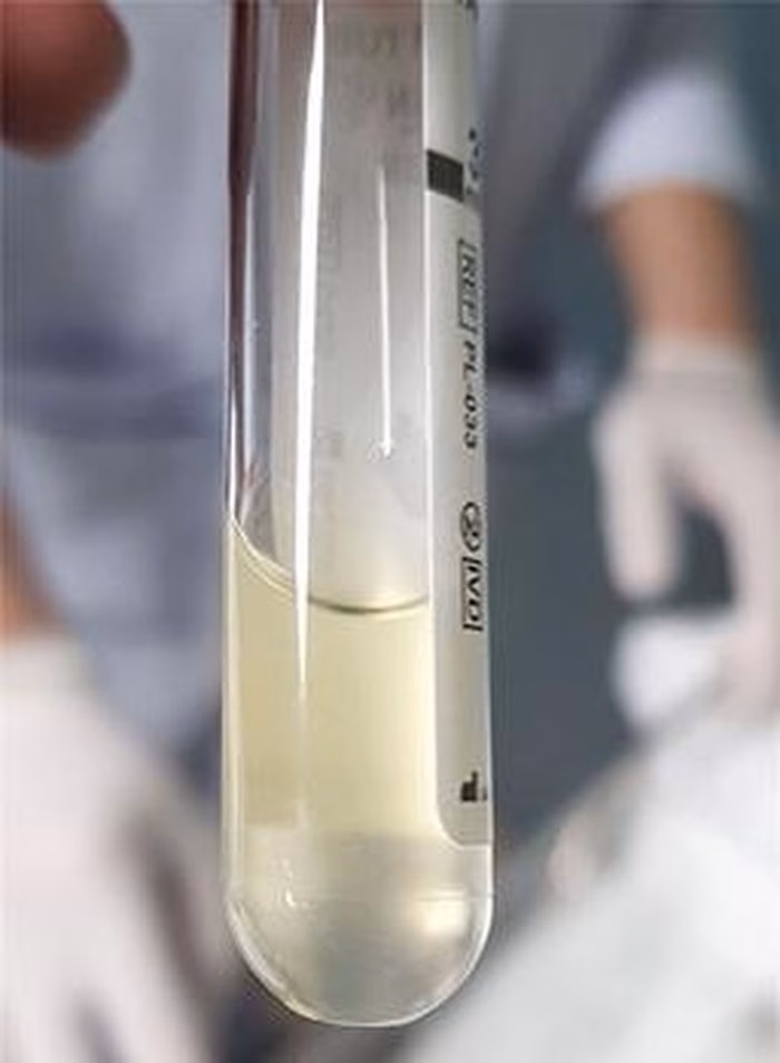 Bệnh nh&acirc;n sau khi ngưng thở m&aacute;y