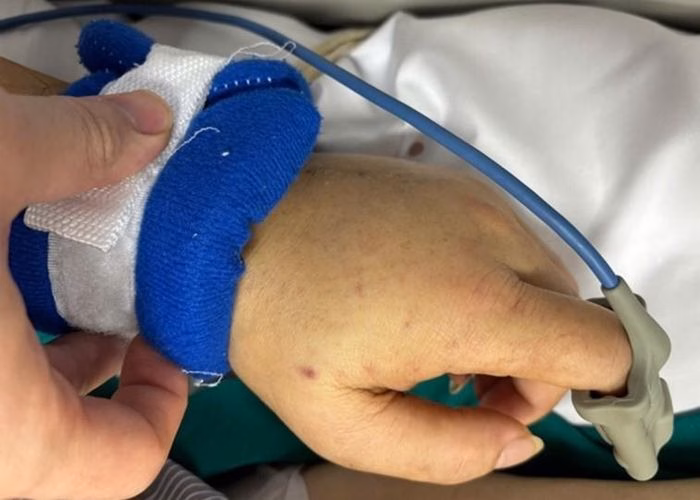 Viêm màng não do não mô cầu: Nguy cơ cao, cách phòng ngừa hiệu quả