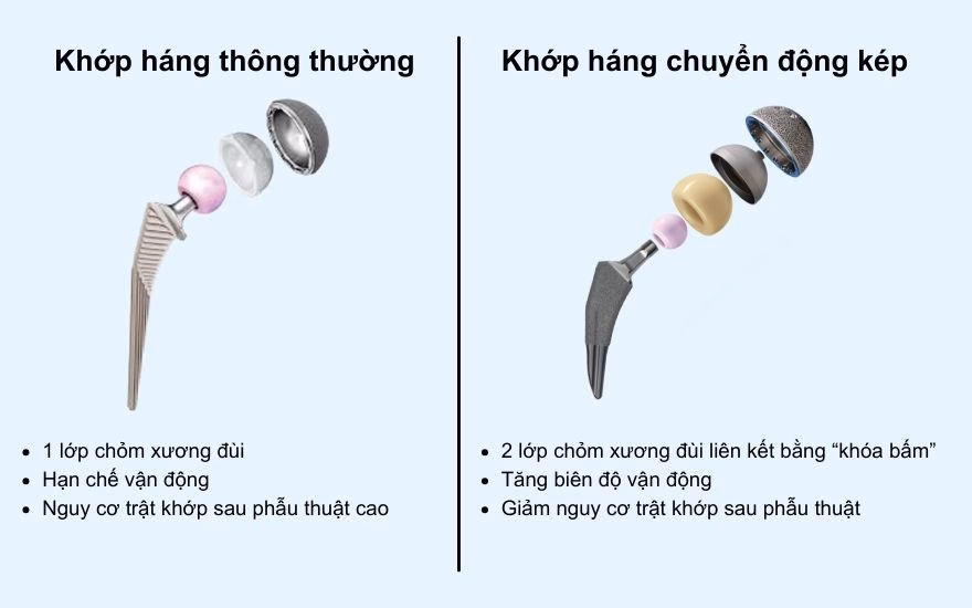 Khớp háng Dual Mobility vs truyền thống Sơ đồ khớp háng Dual Mobility so với khớp truyền thống