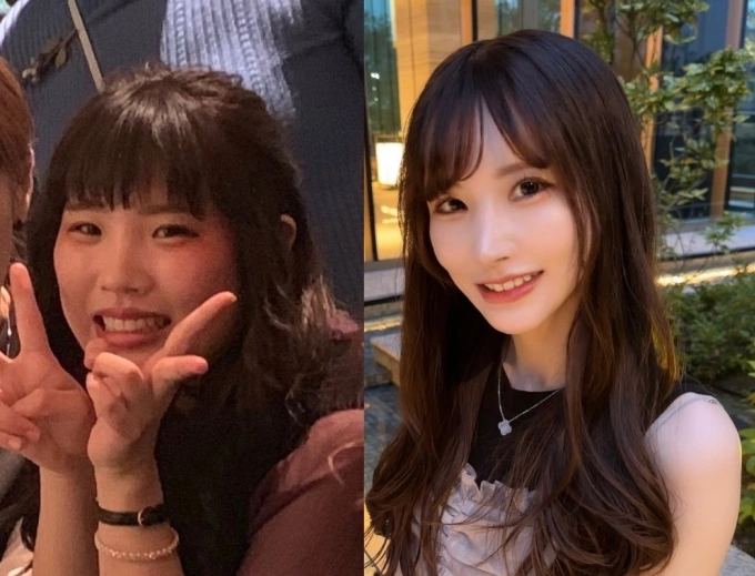 Trước v&agrave; sau phẫu thuật thẩm mỹ của Rara