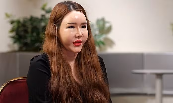 Bi Kịch 140 Triệu Won Và Vòng Xoáy Ám Ảnh Phẫu Thuật Thẩm Mỹ Của Nữ Người Mẫu