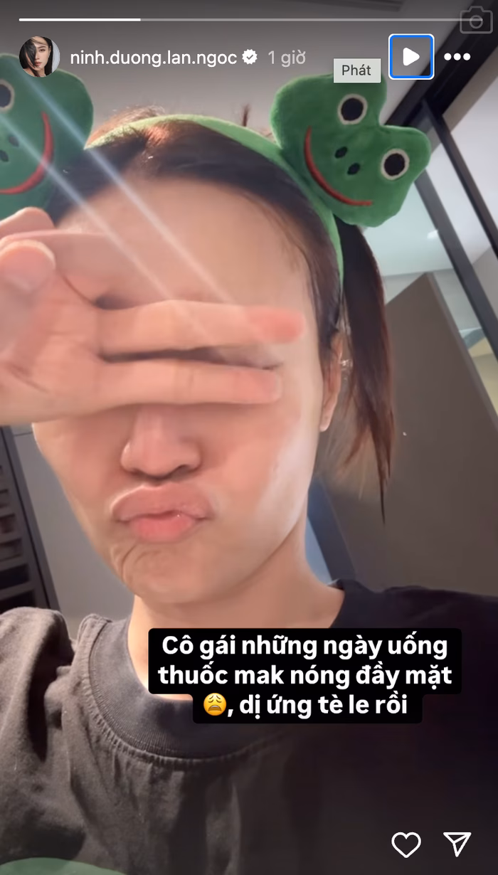 Ninh Dương Lan Ngọc bị dị ứng Ninh Dương Lan Ngọc bị dị ứng