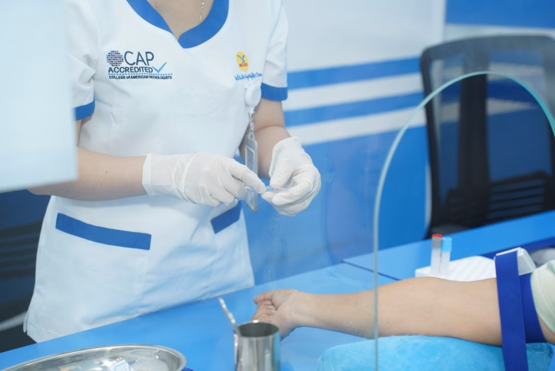 Test dị ứng Bệnh nhân xét nghiệm test dị ứng