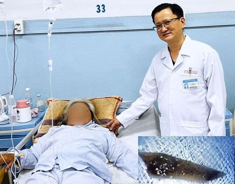 Bệnh nhân hóc dị vật và mảnh xương vịt đâm thủng thành thực quản