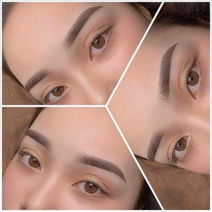 Rủi ro khi làm đẹp Rủi ro khi làm đẹp không đúng cách