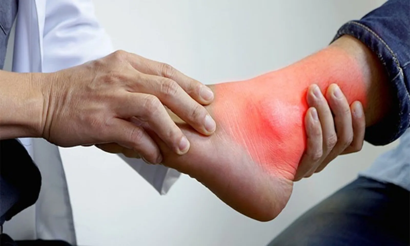Ảnh minh họa bệnh gout Ảnh minh họa bệnh gout