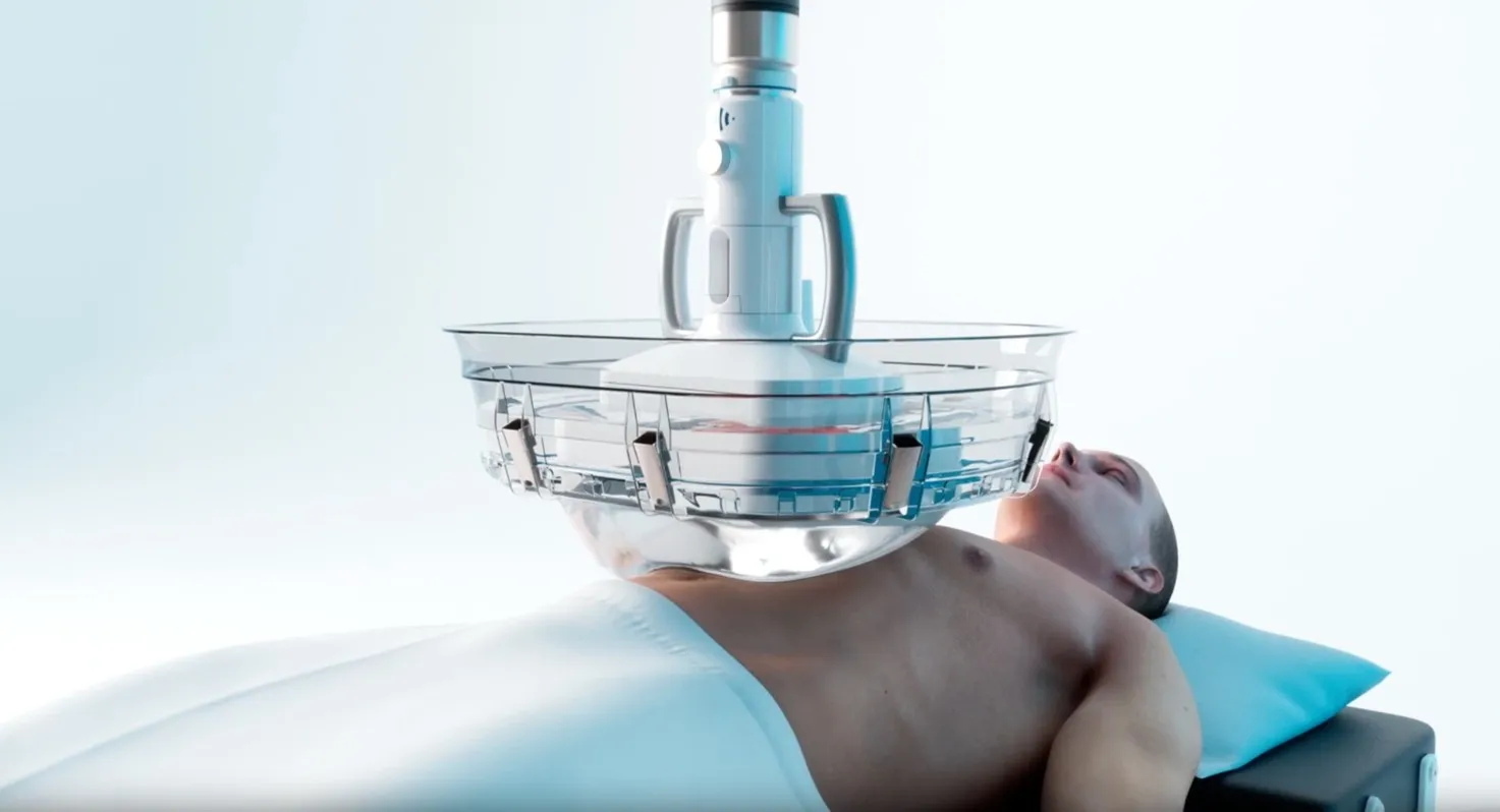 Công nghệ histotripsy Công nghệ histotripsy sử dụng siêu âm để phá vỡ khối u