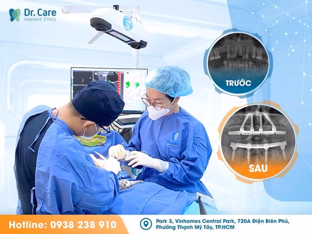 Cải Thiện Quy Trình Trồng Răng Implant Bằng Công Nghệ Kỹ Thuật Số Trồng răng Implant tại Dr. Care: Công nghệ giúp khách hàng không còn sợ đau- Ảnh 2.