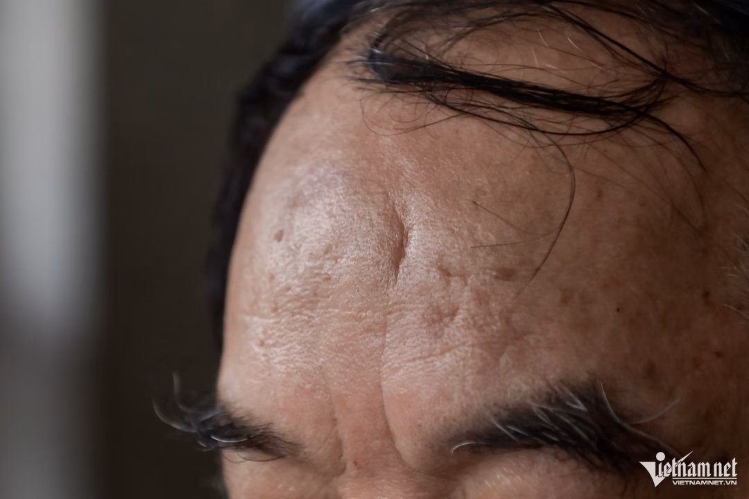 Nơi chăm sóc tận tâm những thương binhพิเศษ