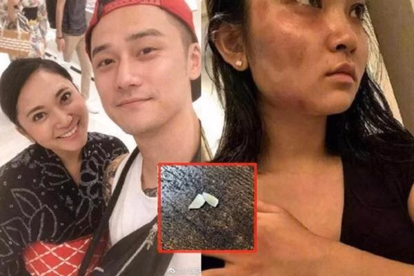 Sao nam Cbiz bạo lực với người yêu: Tấm gương ngôn tình rớt hạng Bạn gái cũ từng đăng tải bằng chứng tố cáo Tưởng Kình Phu